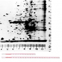 Autoradiography Ruler Set
